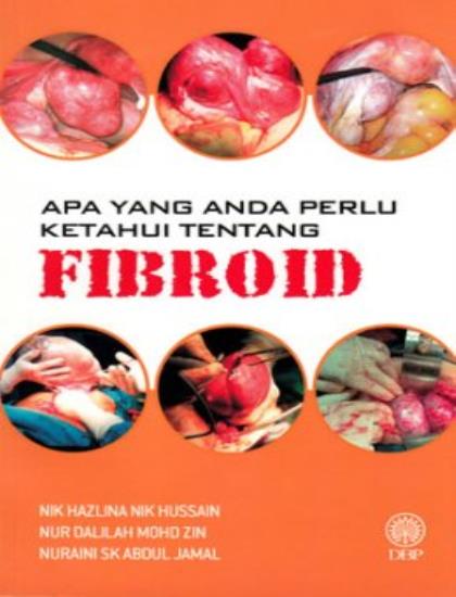 APA YANG ANDA PERLU KETAHUI TENTANG FIBROID
