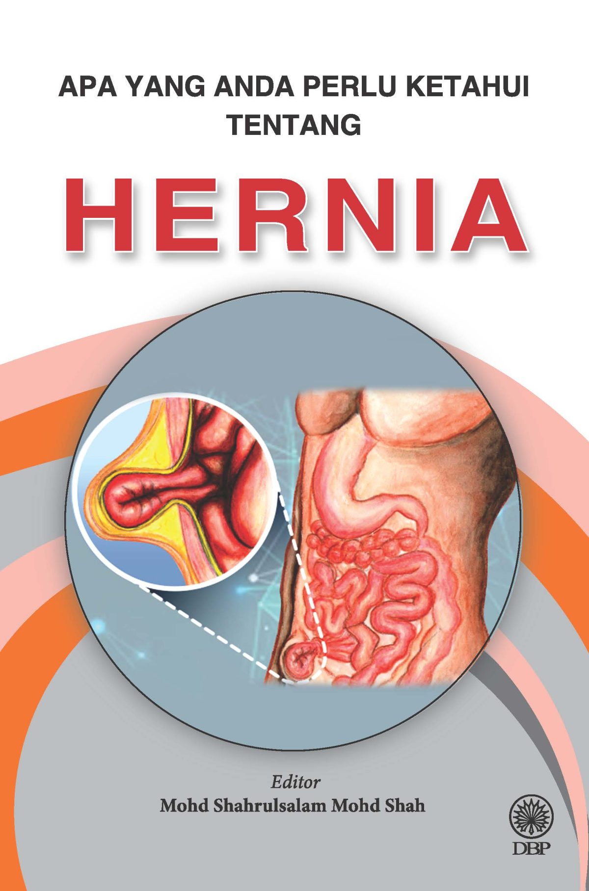 APA YANG ANDA PERLU KETAHUI TENTANG HERNIA