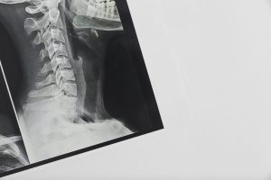 x ray scan